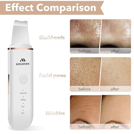 🌸 GlowWave™ 4-in-1 Face Skin Scrubber