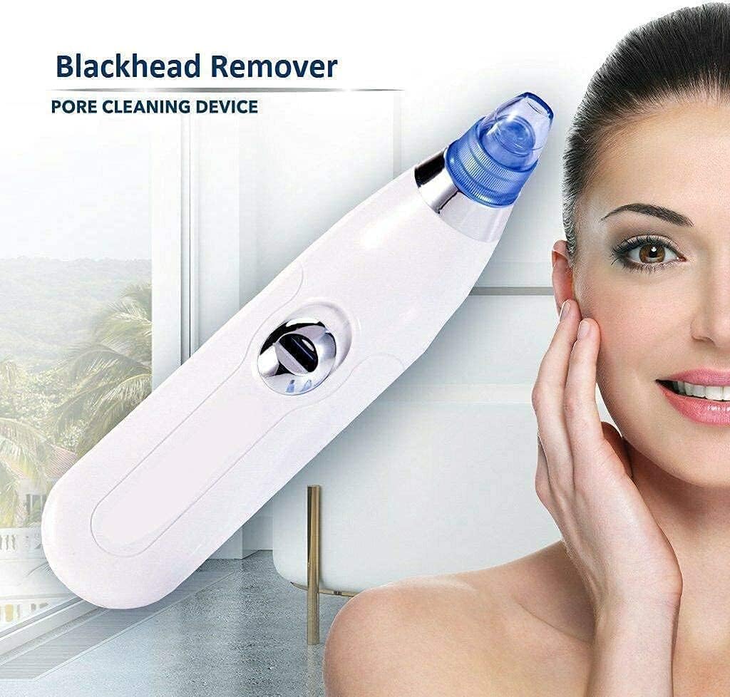 Blackhead Remover – Radiance in Minutes