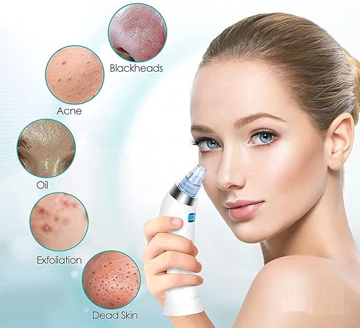 Blackhead Remover – Radiance in Minutes