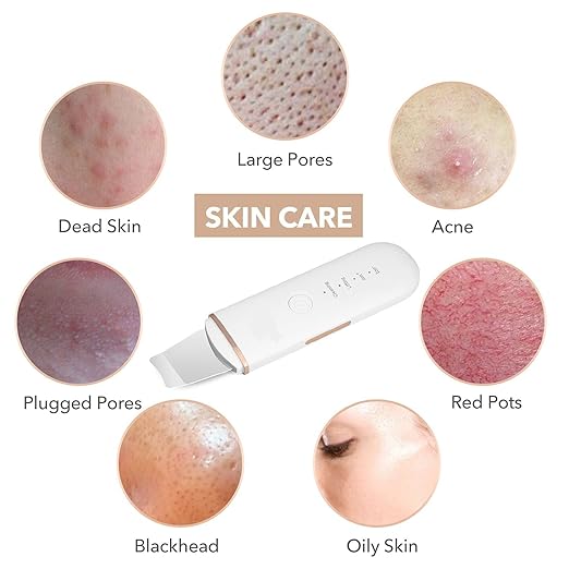 🌸 GlowWave™ 4-in-1 Face Skin Scrubber